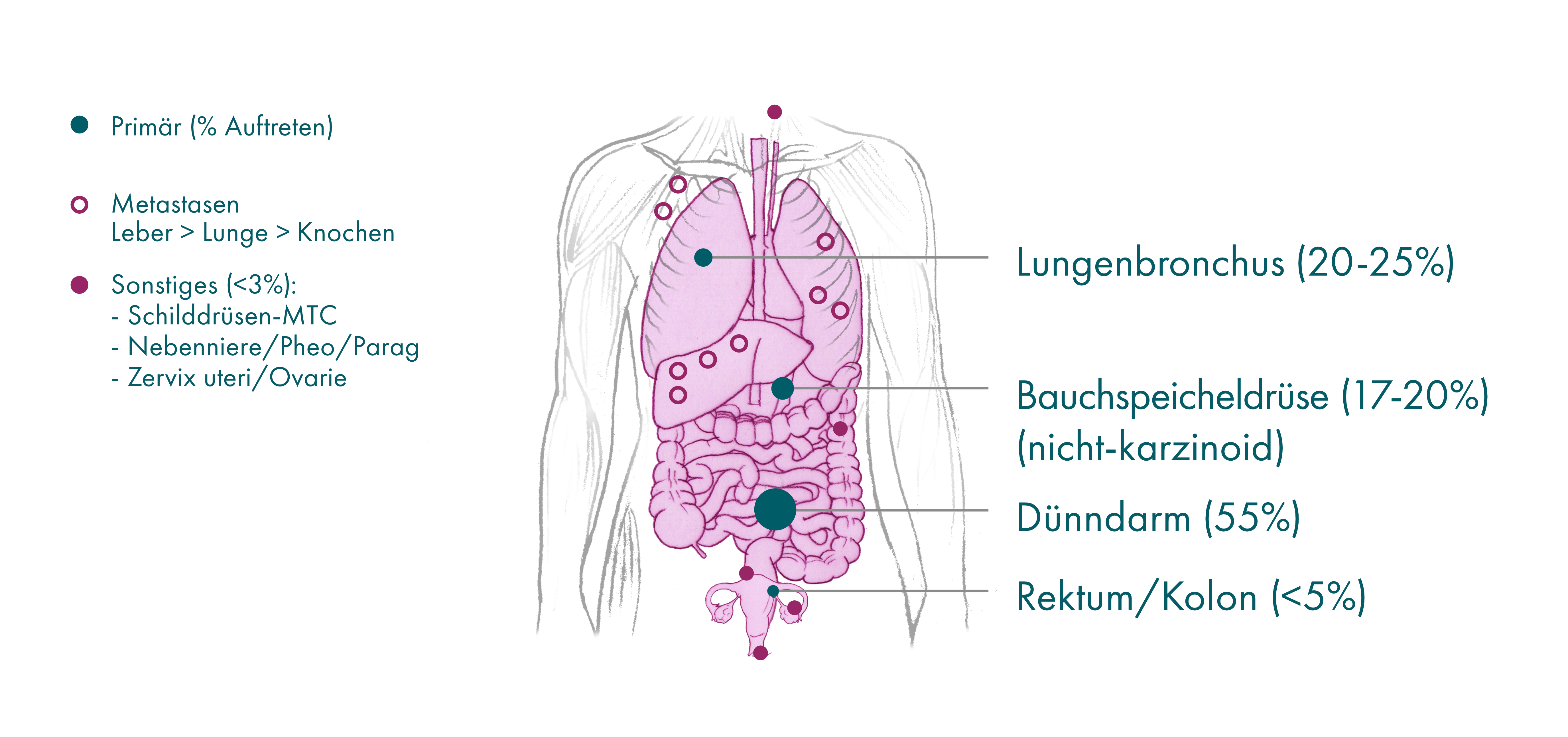 Tumour site of origin German